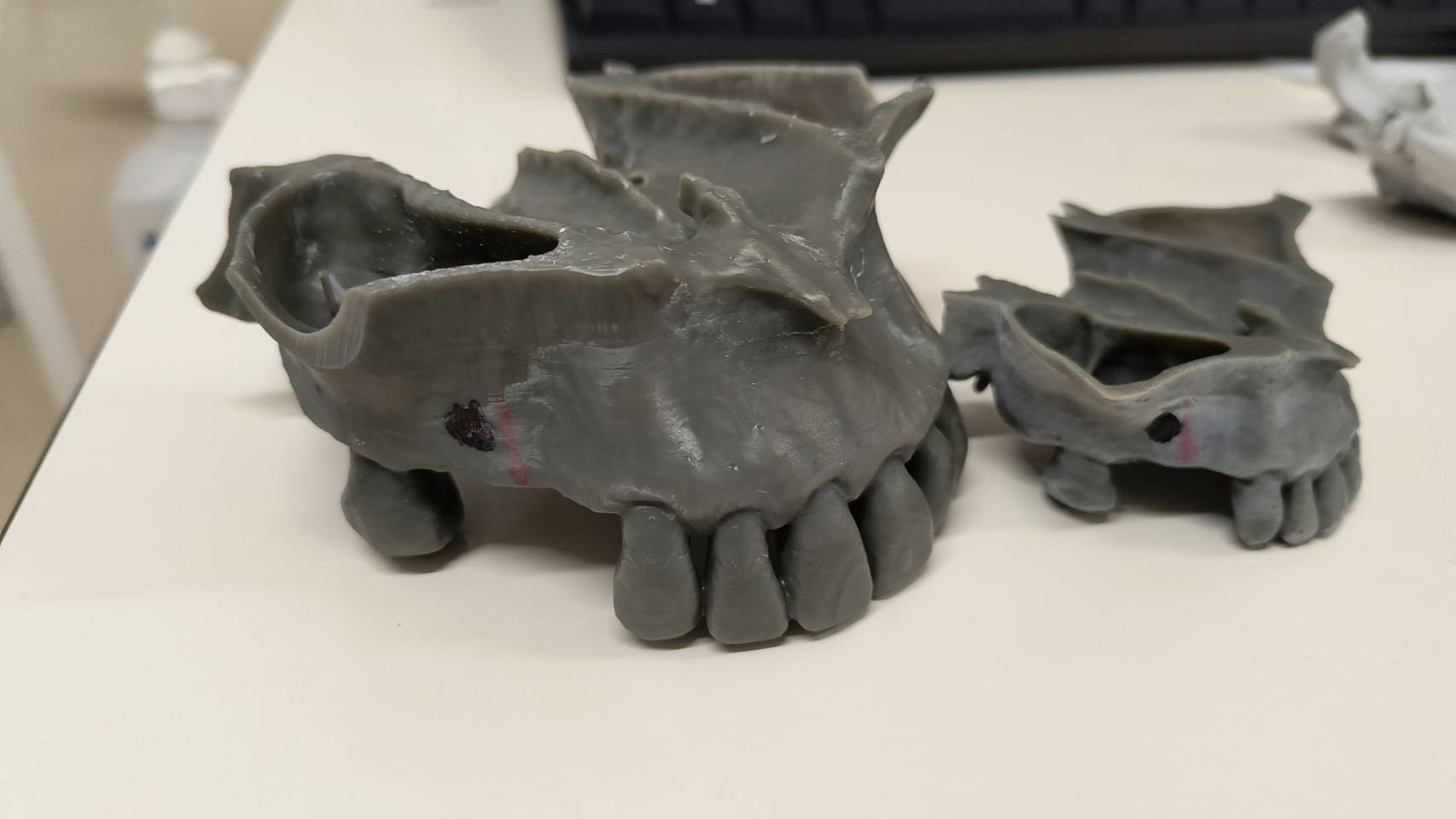 治療費を抑えて、精度は上げる 院内3DプリンターCTの力