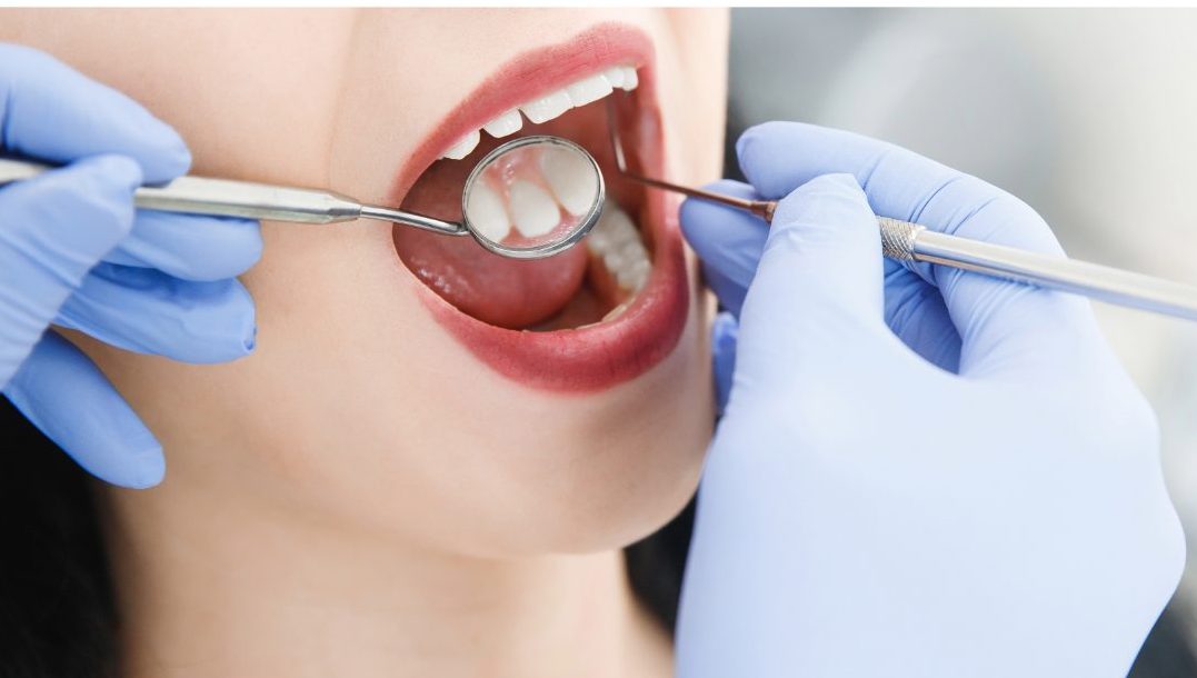 歯の定期健診✨アニメーション