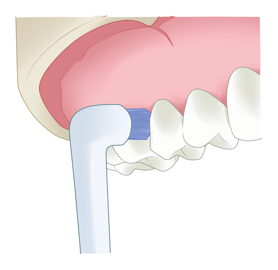 🦷ルシェロ ペリオブラシのご紹介🦷